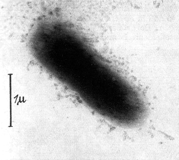 First electron micrograph of a phage