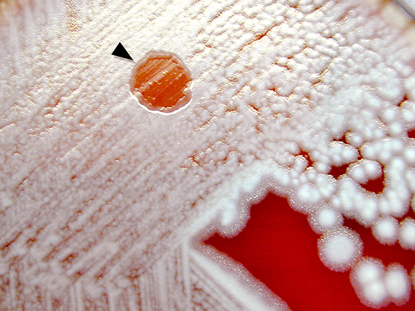 Petri dish showing phage-lysed bacteria culture
