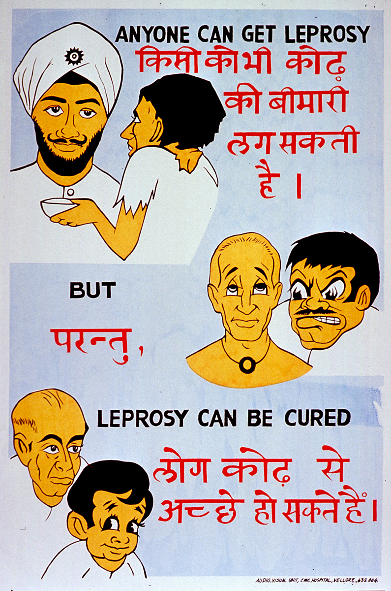 Leprosy public health poster, India