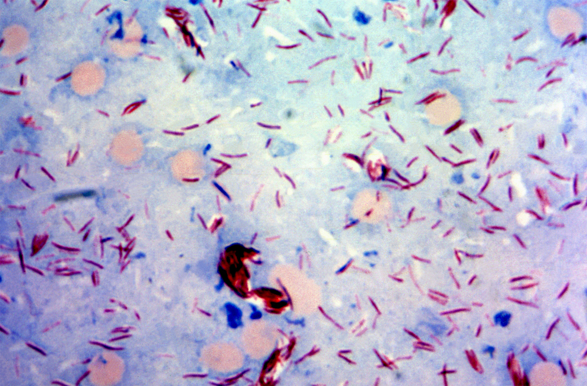 <em>Mycobacterium leprae</em>